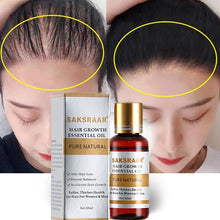 Load image into Gallery viewer, Hair Care Hair Growth Essential Oils Essence