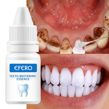Load image into Gallery viewer, EFERO Teeth Whitening Essence Powder Clean Oral Hygiene Whiten Teeth Remove Plaque Stains Fresh Breath Oral Hygiene Dental Tools
